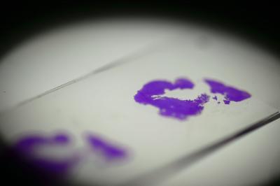 Mouse Tumor