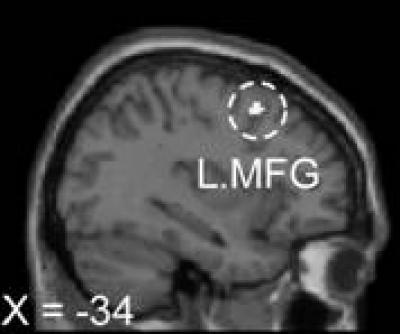 Brain Regions