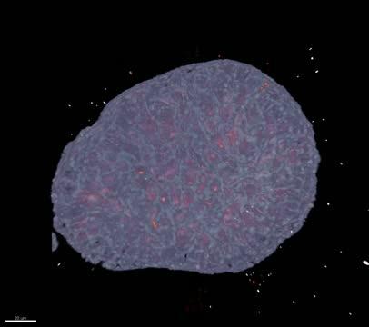 A Kidney Organoid (2 of 2)