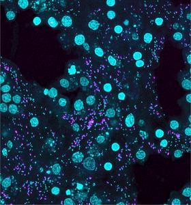 Figure 3: Zooming in on the microbial life inside a sponge.