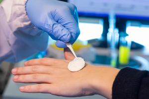 Treating burns with an environmentally friendly plant-based bandage