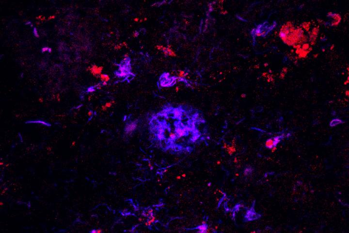 AntiAPOE Antibody