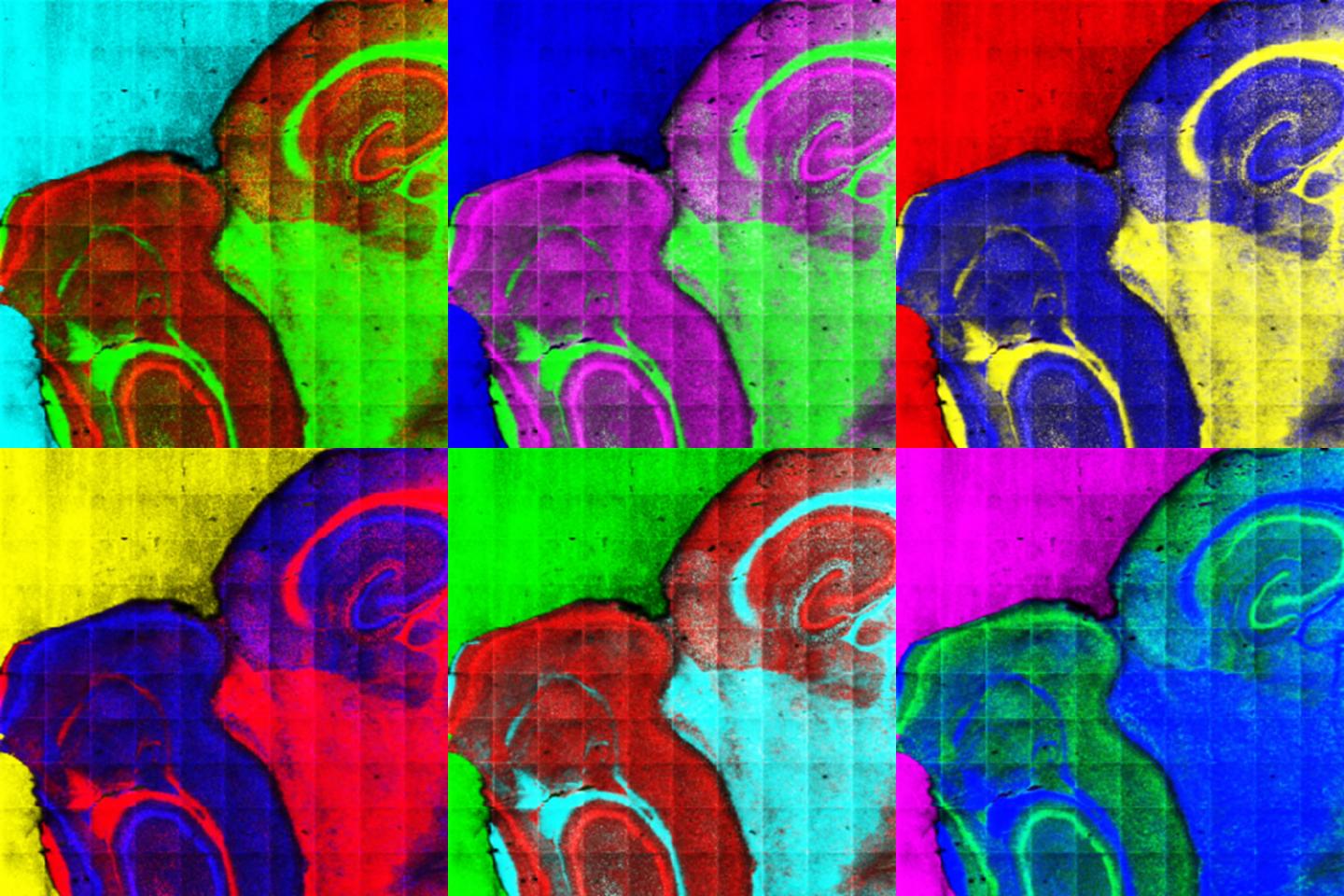 Analysis Using TOF-SIMS of an Area in a Rodent Brain
