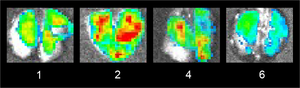 Tracking SARS-CoV-2 infection