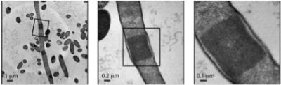 Depletion of ATP in <I>E. coli</I>