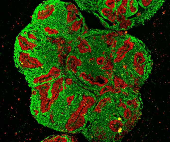 Brain organoid of a rhino
