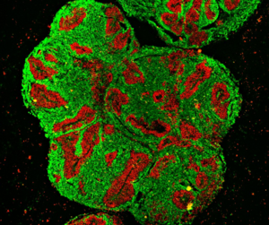 Brain organoid of a rhino