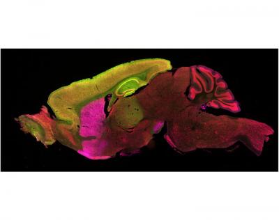 Mouse Brain