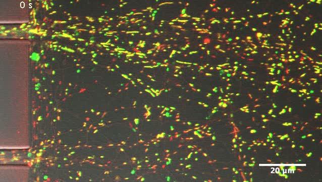 Mitochondria are Damaged by Axonal Injury