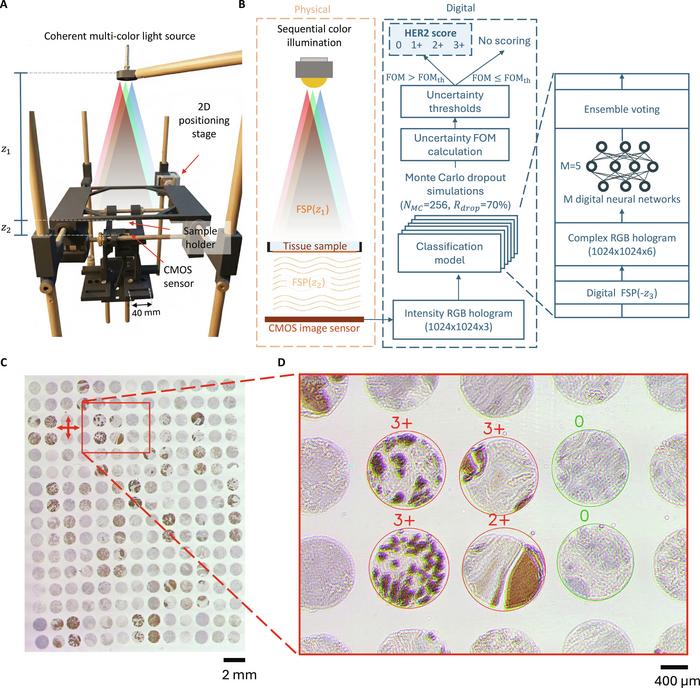 Schematics of the customized lensfree holography system and the digital HER2 classification model