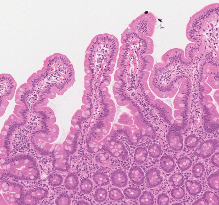 Microscopic image showing healthy villi