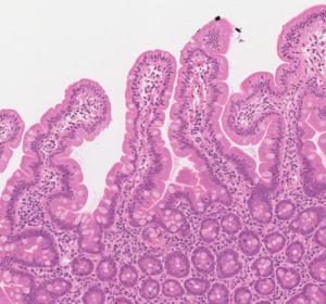 Microscopic image showing healthy villi