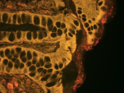Gut Bacteria