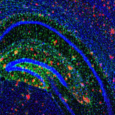 BrainPlaques