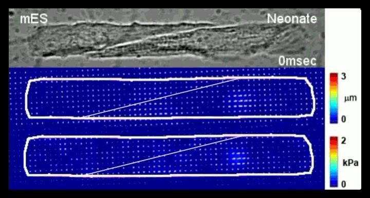 Synchronously Beating Cardiomyocyte in 2-Cell Microtissues