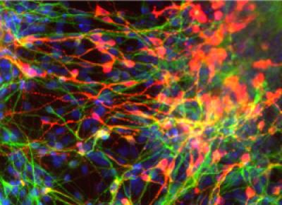 Stained Neurons