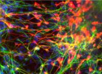 Stained Neurons