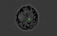A Monocyte Converted into a Decoy by the Malaria Parasite