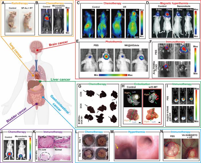 Fig. 6. Microrobotic swarms for the treatment of tumors in different organs.