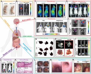 Fig. 6. Microrobotic swarms for the treatment of tumors in different organs.