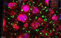 Cancer Biomaterial