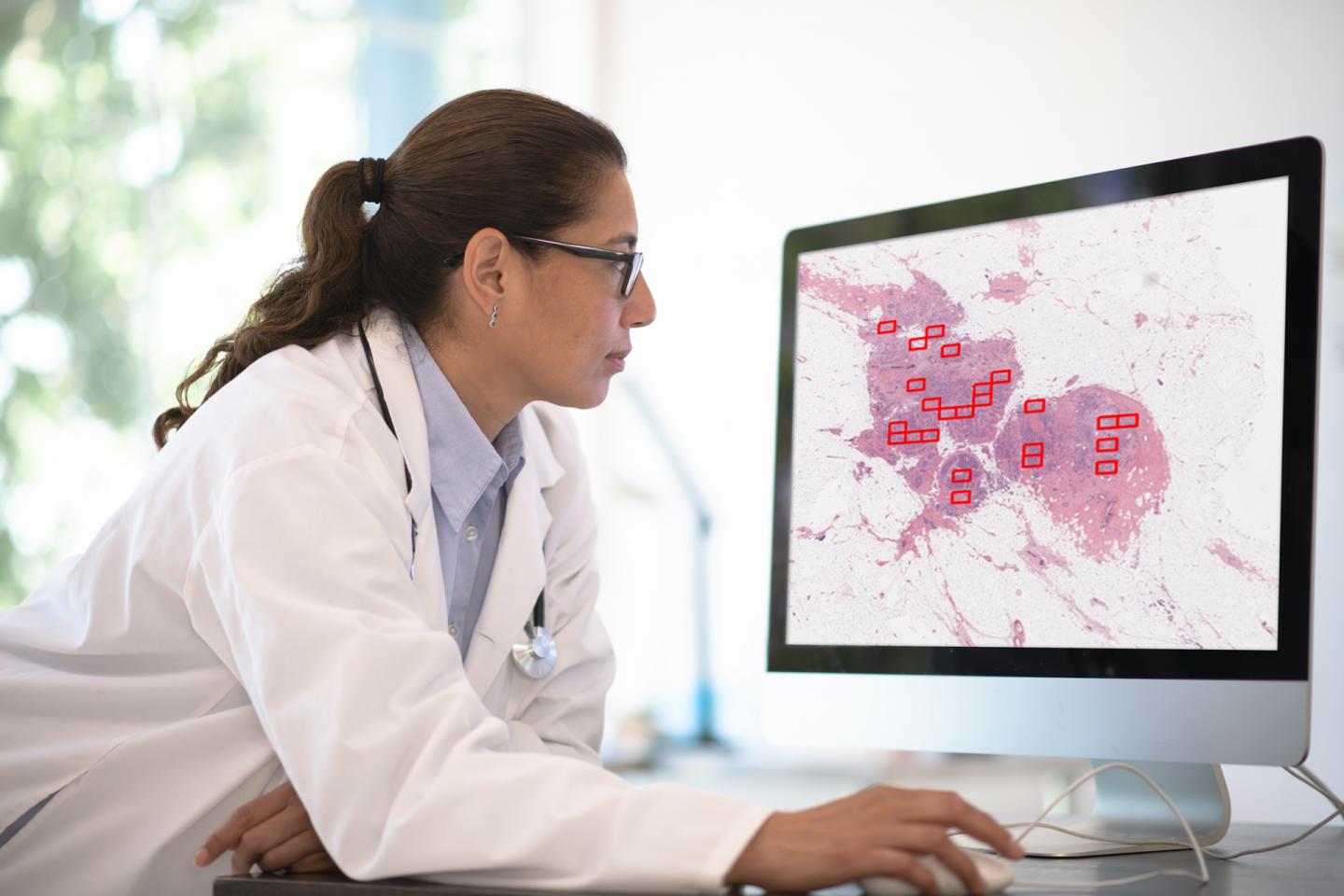 The 4D Q-plasia OncoReader Breast in use