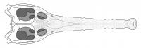 Skull Reconstruction