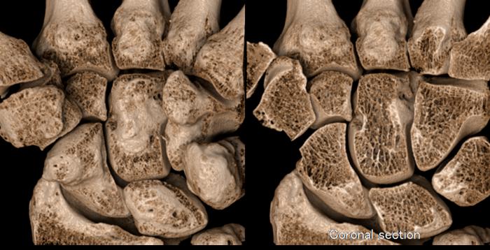 Figure 4. Highly realistic three-dimensional image generated using a novel visualization technique developed in parallel with the CT system.