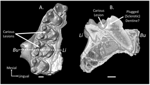 The largest and earliest known sample of dental caries in an extinct mammal (Mammalia, Euarchonta, Microsyops latidens) and its ecological implications