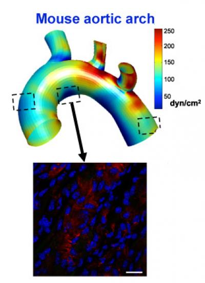 Aorta with LM04 Gene