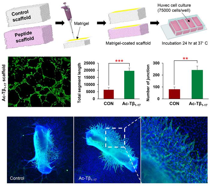 Application of Ac-Tβ1-17 in Promoting Angiogenesis