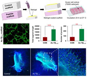 Application of Ac-Tβ1-17 in Promoting Angiogenesis