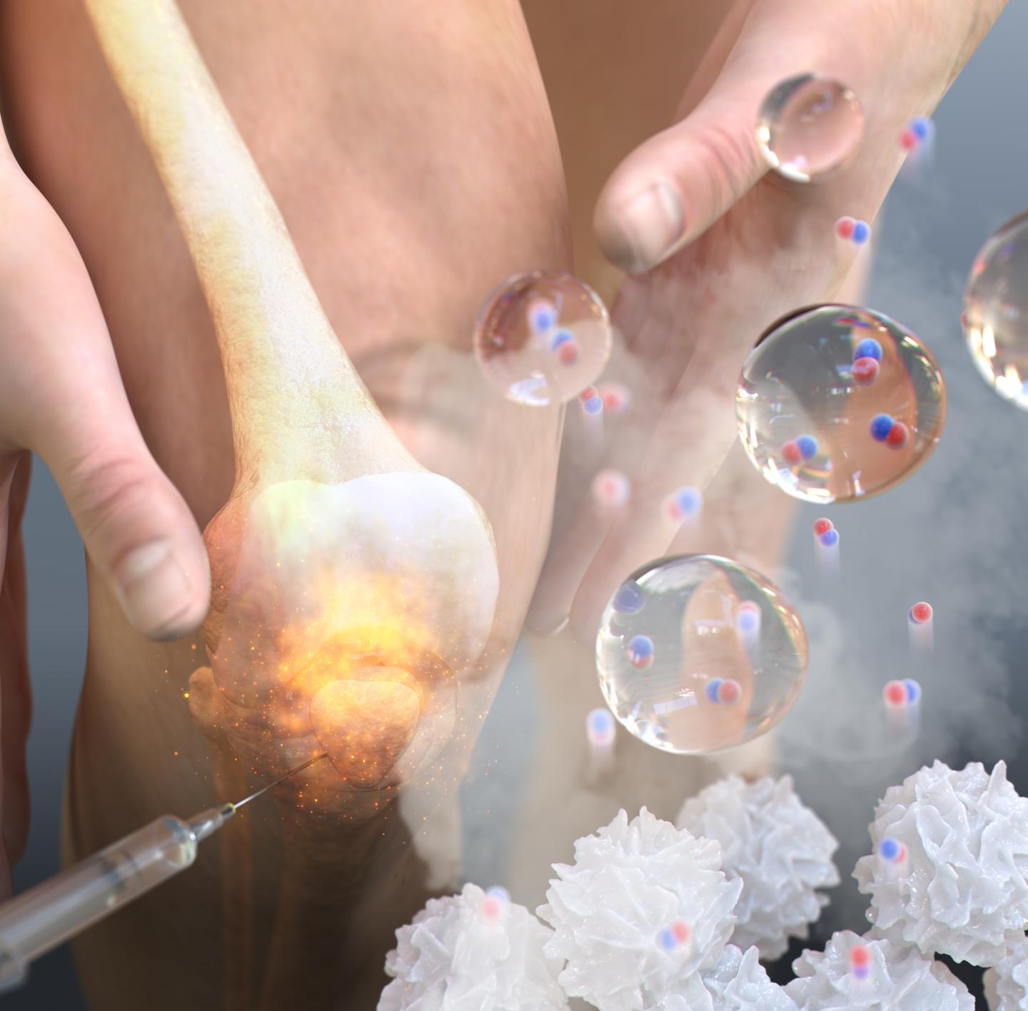 Illustration of NO-Scv Gel-Mediated Anti-inflammation Therapy