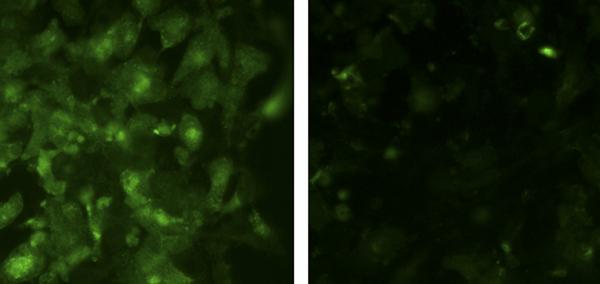 mTORC2 Stimulates Glucose Uptake