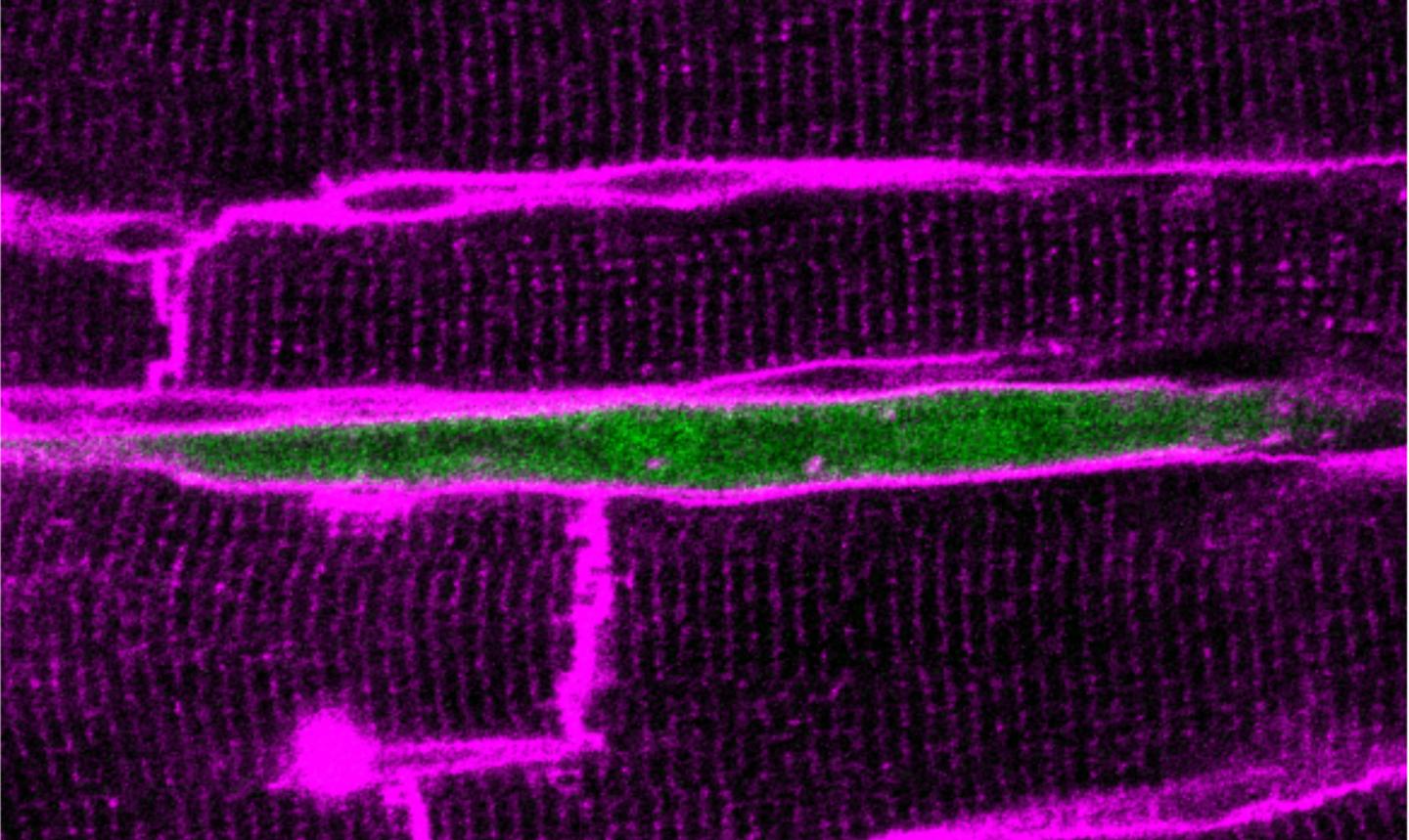 Normal vs. Mutant Cardiomyocytes