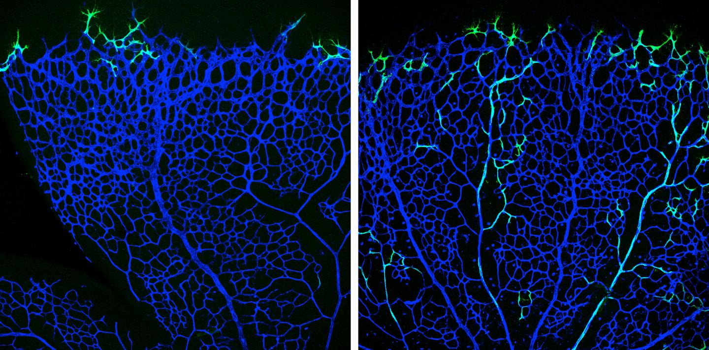 Tip Cells