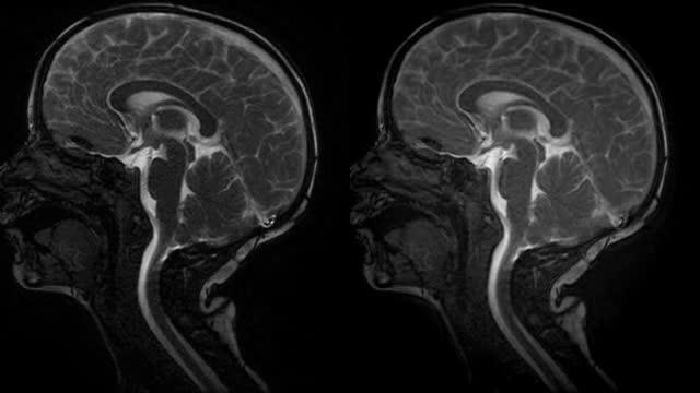 Amplified MRI