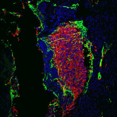 P53 and Somatic Cell Reprogramming
