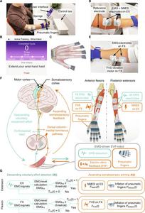 The design of the electromyography (EMG)-driven soft robot with electro-vibro-feedback (EVF-robot).
