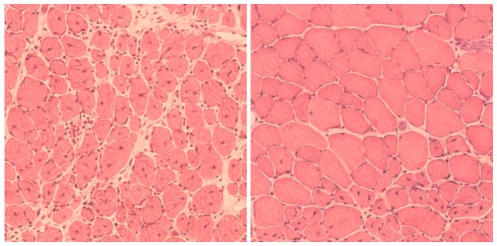 New Technique Rejuvenated Organs and Helped Animals Live Longer