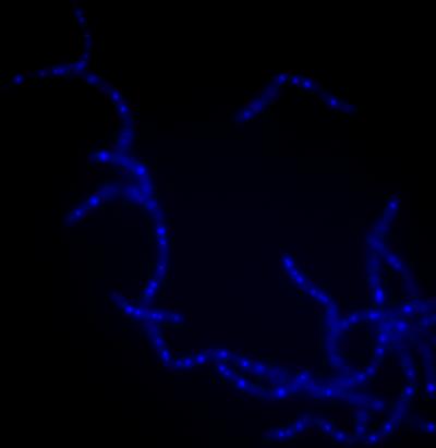Anthrax Cells (1 of 2)