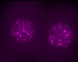 Two Cell Mouse Embryo