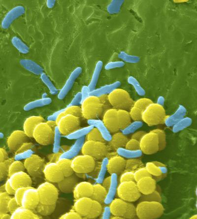 Antibiotic-Resistant Bacteria Have Evolved a Unique Chemical Mechanism, New Discovery Reveals
