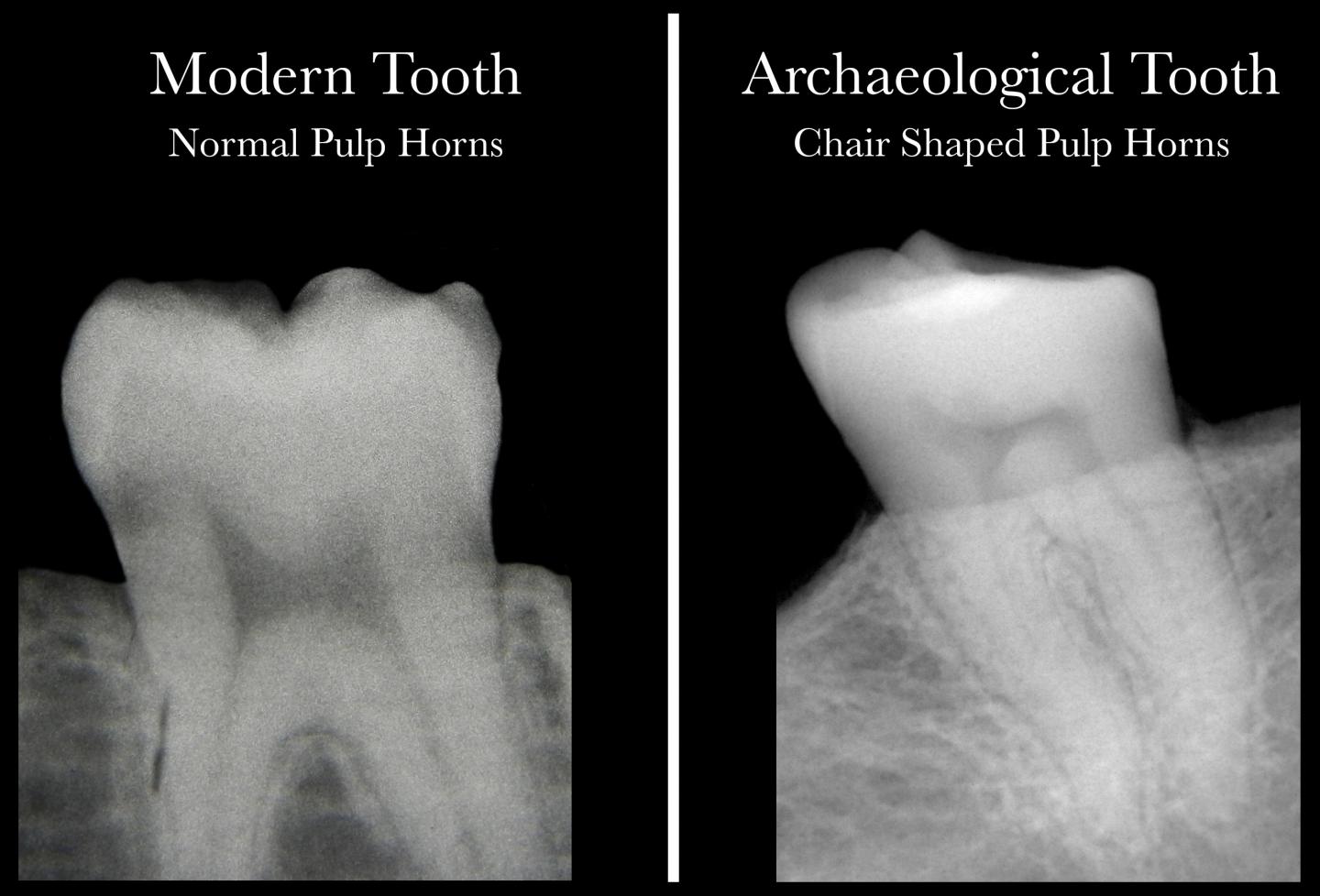 Teeth-comparison