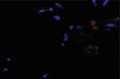 Aged Stem Cell