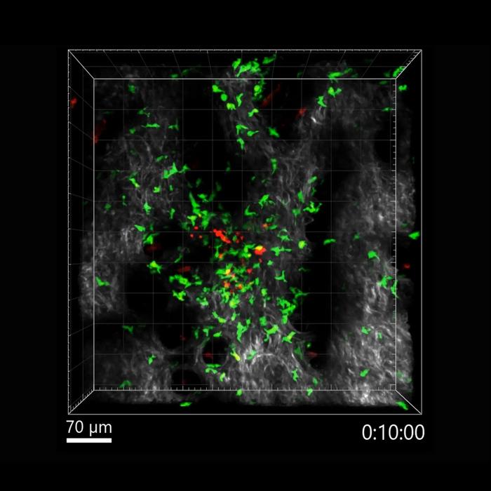 Live microscopic capture of CD4+ T cells attacking cancerous cells