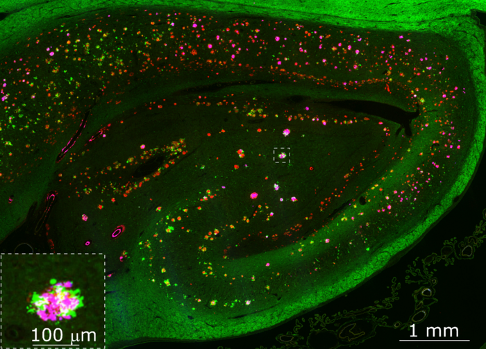 Human hippocampal brain section