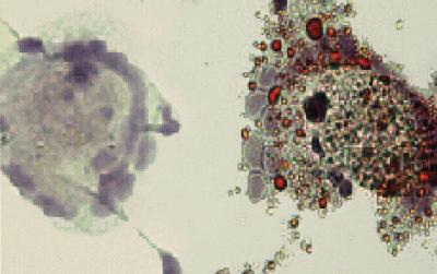 Macrophages Become Foam Cells