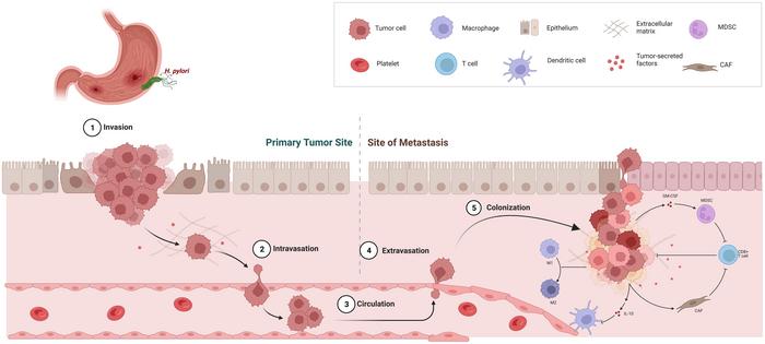 Overview of metastasis and TME