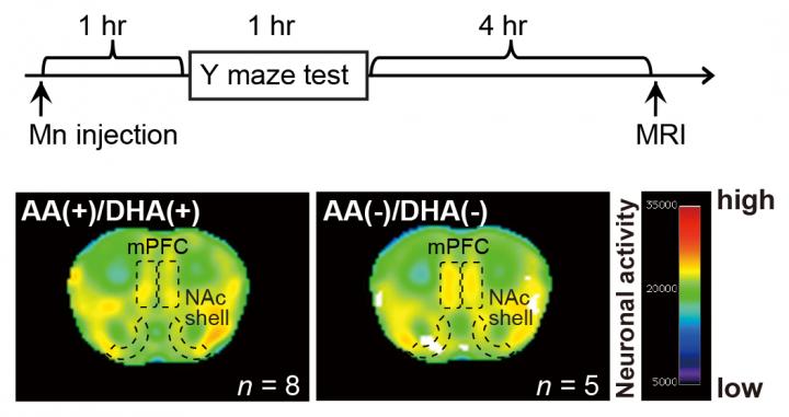 Macroscopic Neuronal Imaging in the AA(+)/DHA(+) and AA(?)/DHA(?) groups
